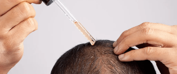 Боротьба з облисінням 1